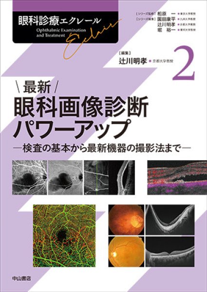 画像1: 最新 眼科画像診断パワーアップ－検査の基本から最新機器の撮影法まで　【眼科診療エクレール 2】 (1)