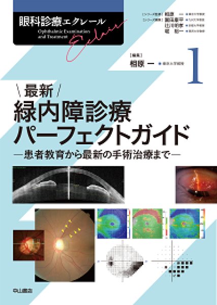 画像1: 最新 緑内障診療パーフェクトガイド－患者教育から最新の手術治療まで　【眼科診療エクレール　1】 (1)