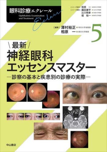 画像1:  最新 神経眼科エッセンスマスターー診察の基本と疾患別の診療の実際 [眼科診療エクレール　5]  (1)