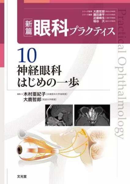 画像1: 神経眼科はじめの一歩（新篇眼科プラクティス  10) (1)