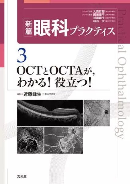 画像1: OCTとOCTAが，わかる！役立つ！（新篇眼科プラクティスシリーズ 3） (1)