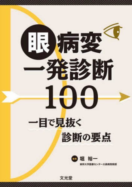 画像1: 眼病変一発診断100　一目で見抜く診断の要点 (1)