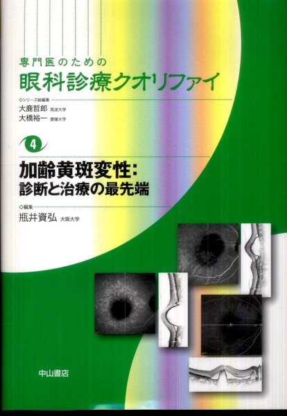 画像1: 加齢横斑変性―診断と治療の最先端　[専門医のための眼科診療クオリファイ　4] (1)