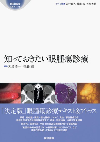 画像1: 知っておきたい眼腫瘍診療　[眼科臨床エキスパート] (1)