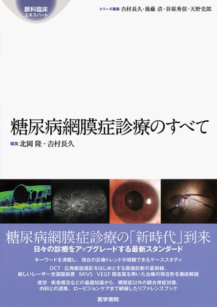 画像1: 糖尿病網膜症診療のすべて　[眼科臨床エキスパート] (1)