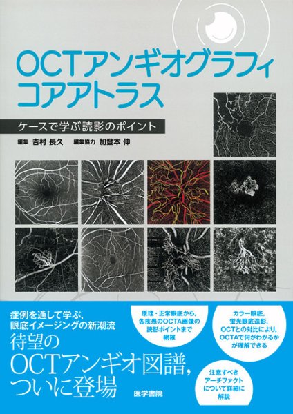 画像1: OCTアンギオグラフィコアアトラス　ケースで学ぶ読影のポイント (1)