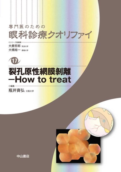 画像1: 裂孔原性網膜剥離－How to treat　[専門医のための眼科診療クオリファイ　17] (1)