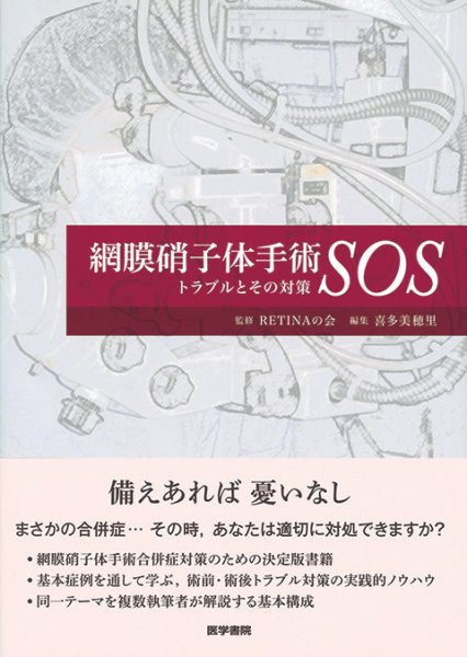 画像1: 網膜硝子体手術SOS トラブルとその対策 (1)