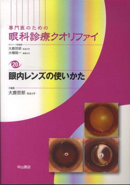 画像1: 眼内レンズの使いかた　[専門医のための眼科診療クオリファイ　20] (1)