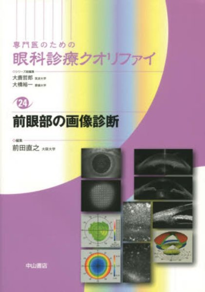 画像1: 前眼部の画像診断　[専門医のための眼科診療クオリファイ　24] (1)