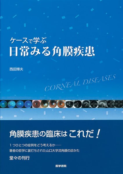 画像1: ケースで学ぶ 日常みる角膜疾患 (1)