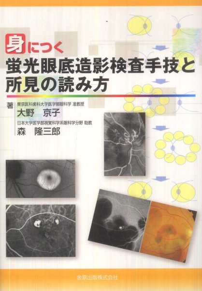 画像1: 身につく蛍光眼底造影検査手技と所見の読み方 (1)