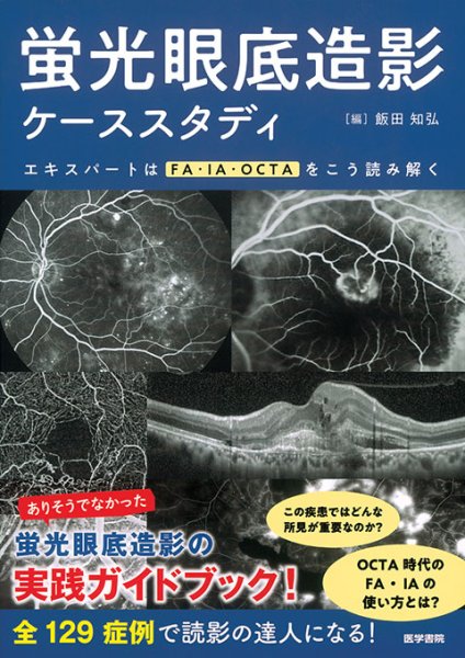 画像1: 蛍光眼底造影ケーススタディ　エキスパートはFA・IA・OCTAをこう読み解く (1)