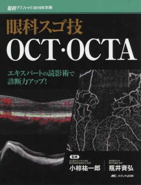 画像1: 眼科スゴ技 OCT・OCTA（眼科グラフィック　2019年別冊） (1)