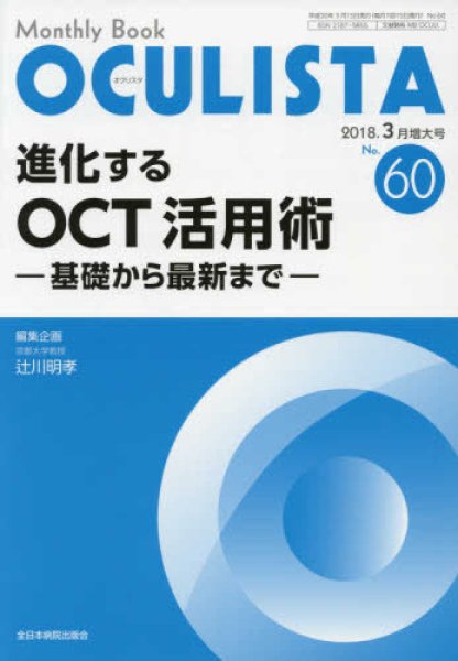 画像1: 進化するOCT活用術　-基礎から最新まで-（MB OCULISTA no.60 2018.3月増大号） (1)