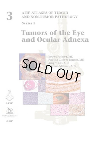 画像1: Tumors of the Eye and Ocular Adnexa（Atlases of Tumor and Non-Tumor Pathology, Series 5,volume 3） (1)