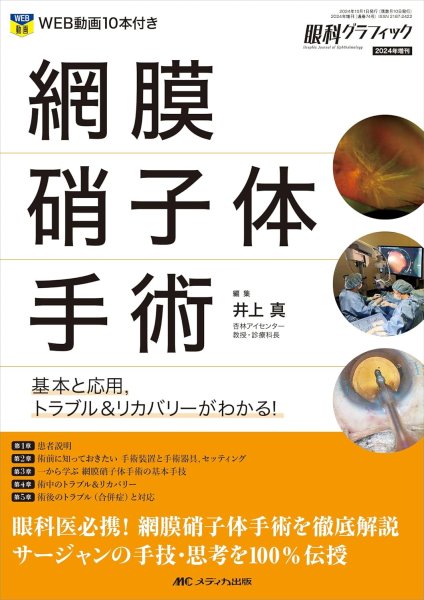 画像1: 網膜硝子体手術：基本と応用，トラブル＆リカバリーがわかる！ (眼科グラフィック2024年増刊) (1)