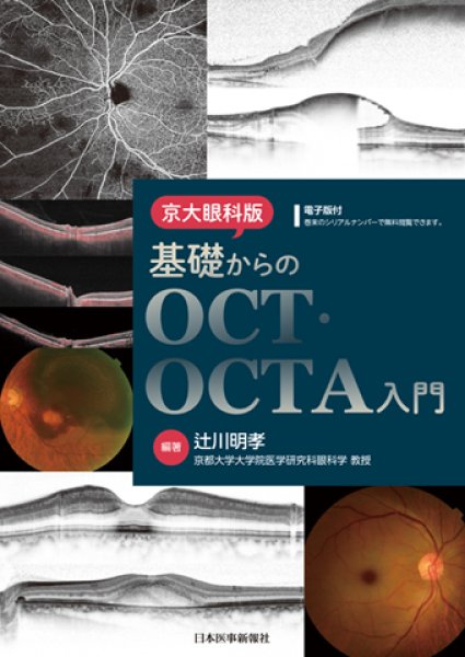 画像1: 京大眼科版 基礎からのOCT・OCTA入門 (1)