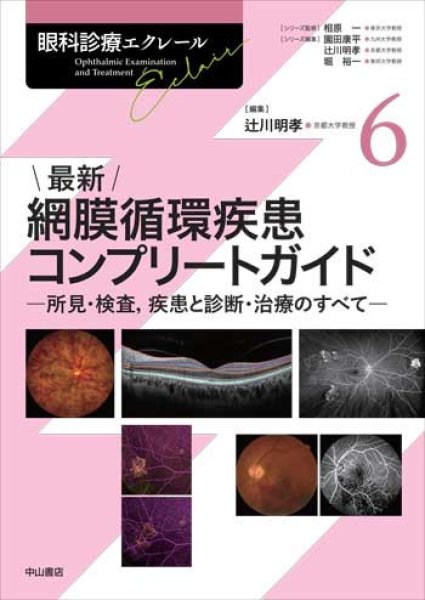 画像1: 最新 網膜循環疾患コンプリートガイド－所見・検査，疾患と診断・治療のすべて [眼科診療エクレール　6]  (1)