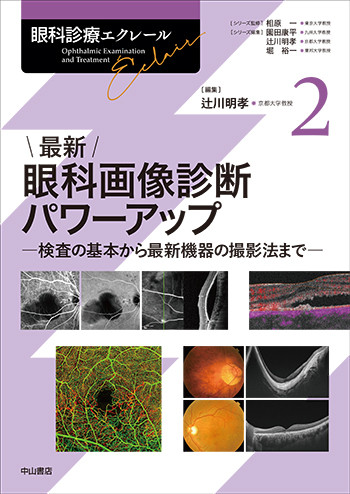 最新 眼科画像診断パワーアップ－検査の基本から最新機器の撮影法まで　【眼科診療エクレール 2】