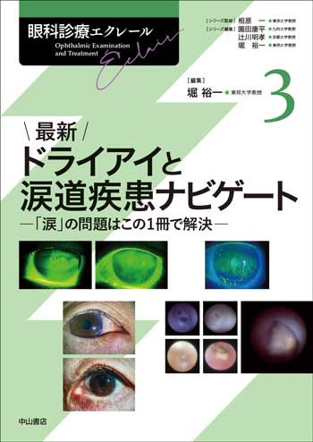  最新 ドライアイと涙道疾患ナビゲート 　[眼科診療エクレール　3] 