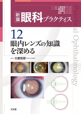 眼内レンズの知識を深める（新篇眼科プラクティス  12)