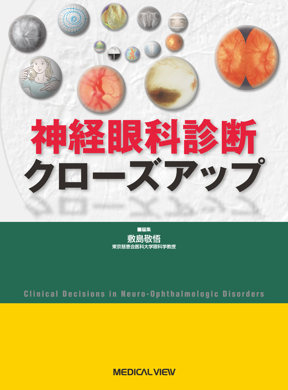 神経眼科診断クローズアップ