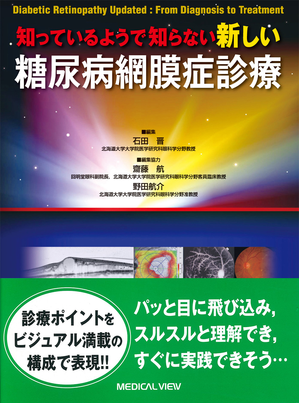 知っているようで知らない 新しい糖尿病網膜症診療