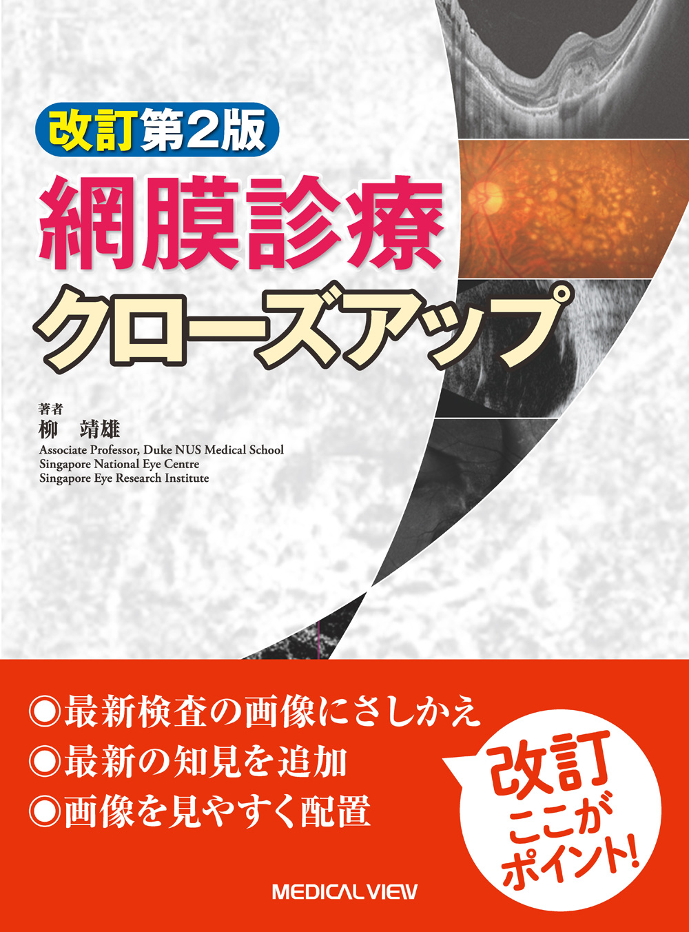 網膜診療クローズアップ　改訂第2版