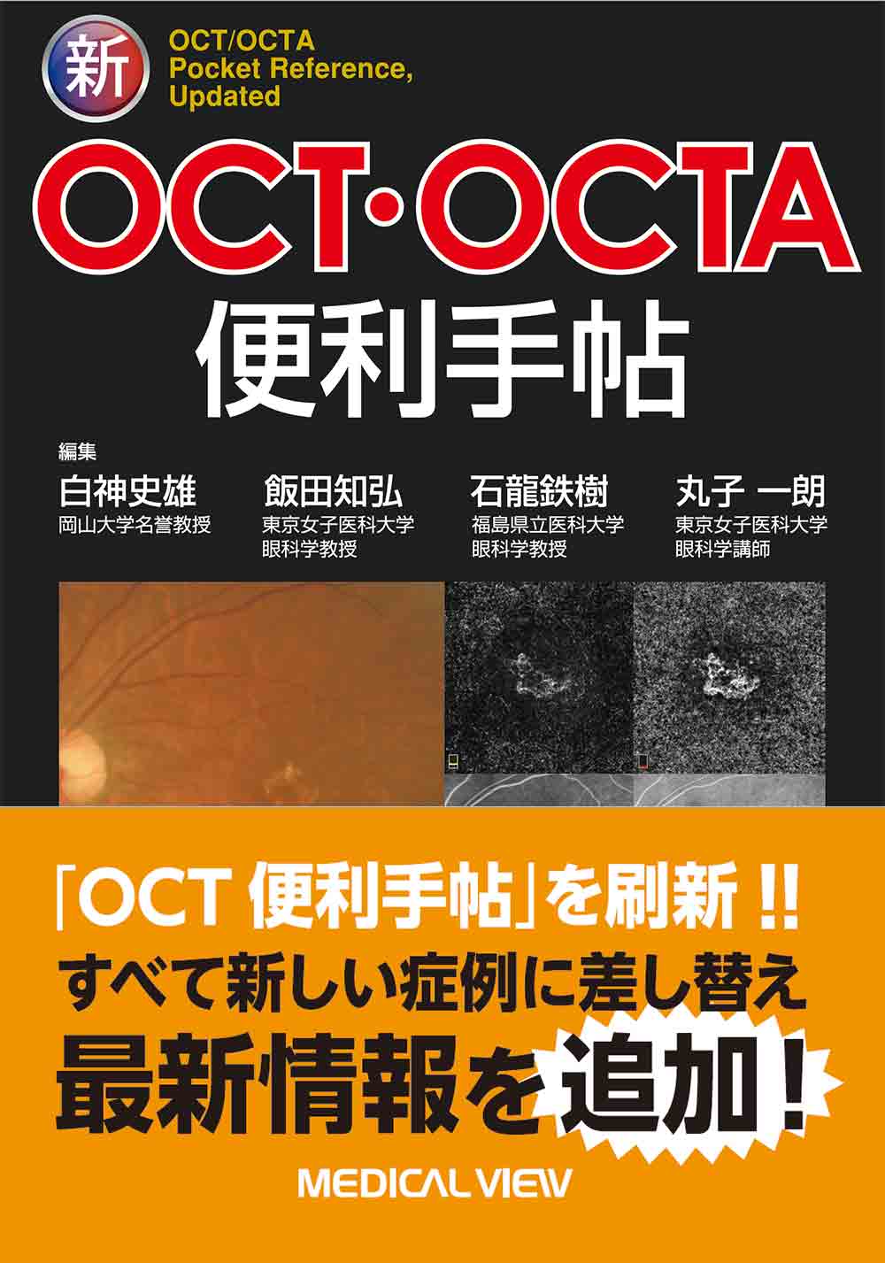 新OCT/OCTA便利手帖