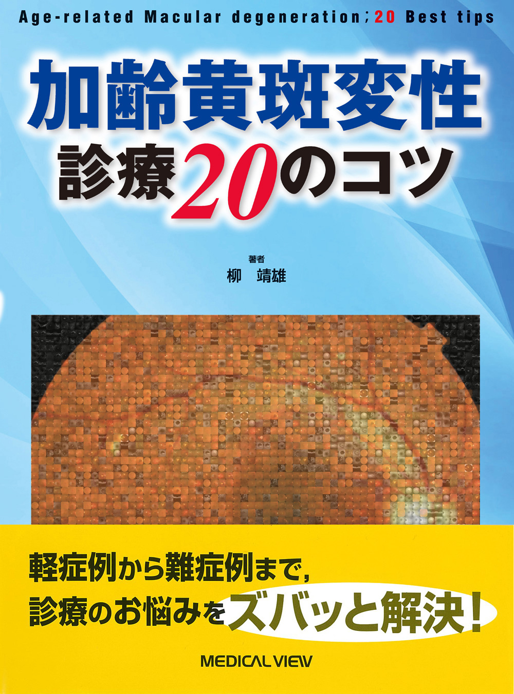 加齢黄斑変性　診療20のコツ