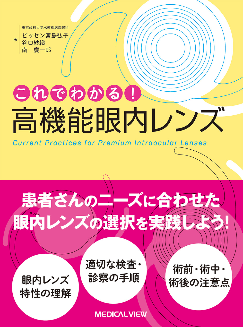 これでわかる！　高機能眼内レンズ