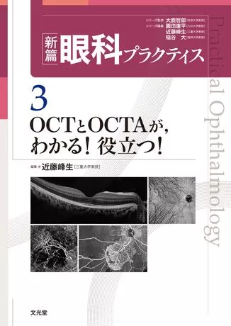 OCTとOCTAが，わかる！役立つ！（新篇眼科プラクティスシリーズ 3）