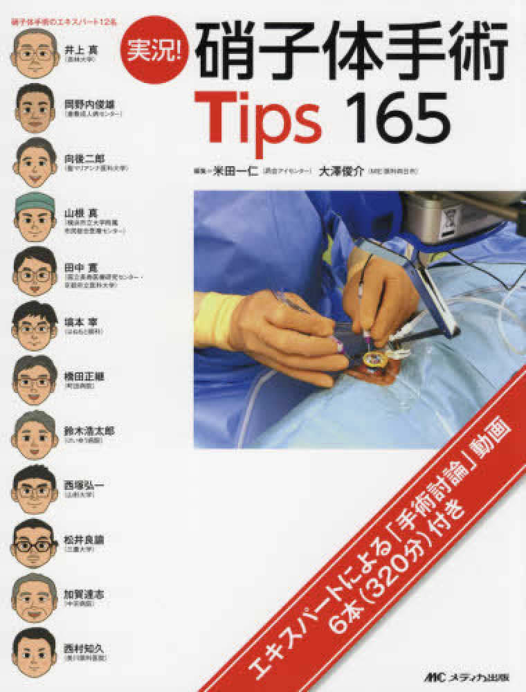 実況！ 硝子体手術Tips165