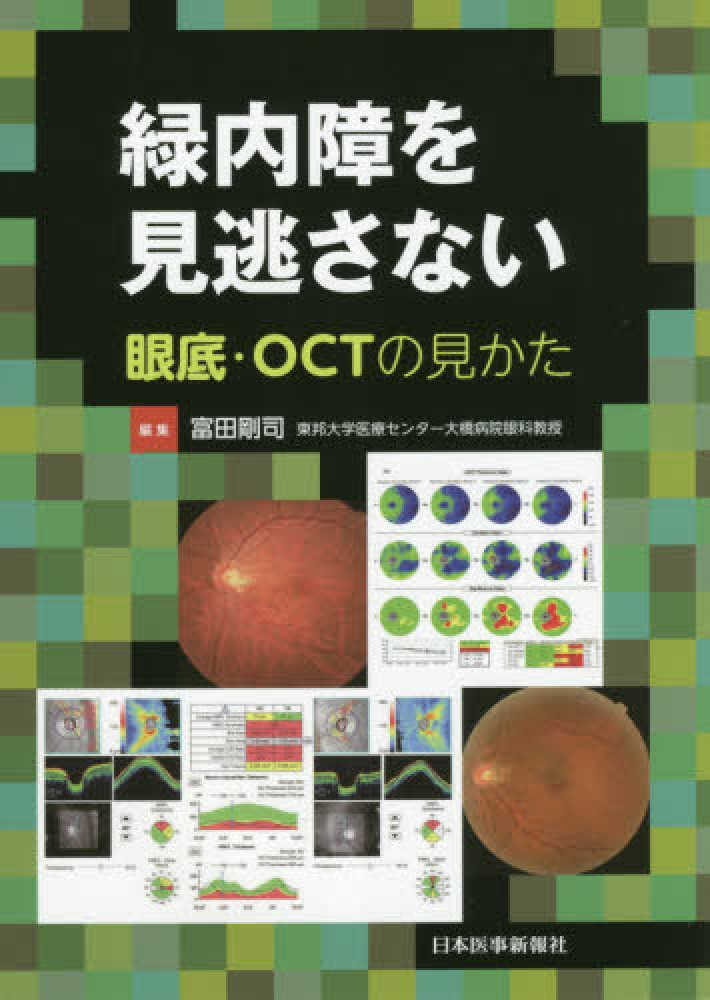 緑内障を見逃さない 眼底・OCTの見かた