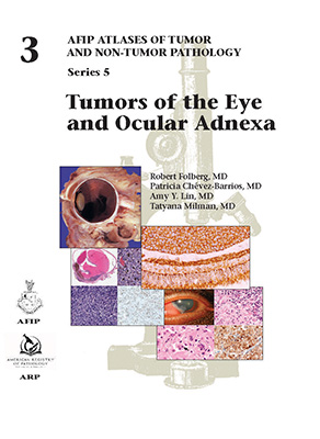 Tumors of the Eye and Ocular Adnexa（Atlases of Tumor and Non-Tumor Pathology, Series 5,volume 3）